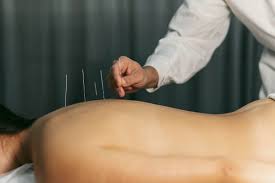 dryneedle